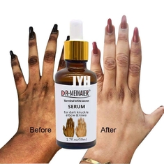GMPC Bodycare Kozmetik Beyazlatıcı El Knuckle Glow Serum Koyu Knuckle Dirseği Çıkarmak İçin