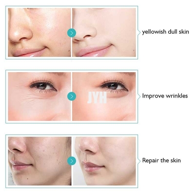 Elma Kök Hücre Kırışıklık Giderici Serum Hassas Ciltler İçin Antioksidan Serum