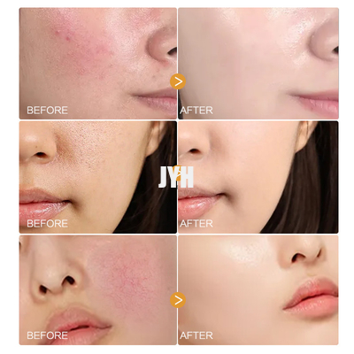 MSDS Yüz Cilt Bakım Ürünleri Organik Papatya Yapraklı Serum Hassas Ciltler İçin Doğal Yüz Serumu