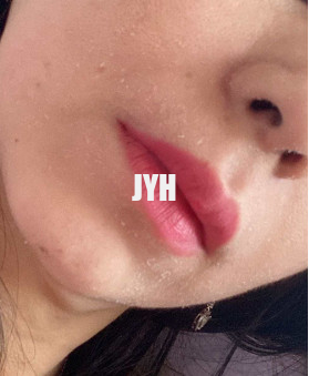 %10 Glikolik Asit Nemlendirici Yüz Toneri 100ml Cilt Bakımı Kimyasal Peeling Cildi Aydınlatır
