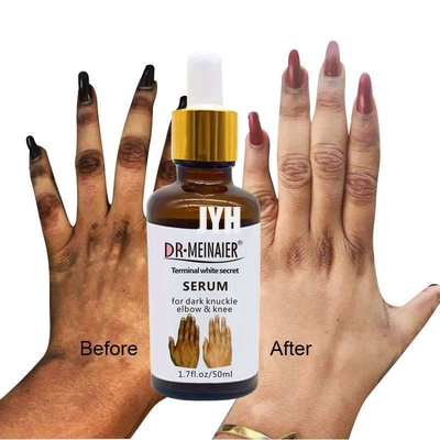 GMPC Bodycare Kozmetik Beyazlatıcı El Knuckle Glow Serum Koyu Knuckle Dirseği Çıkarmak İçin