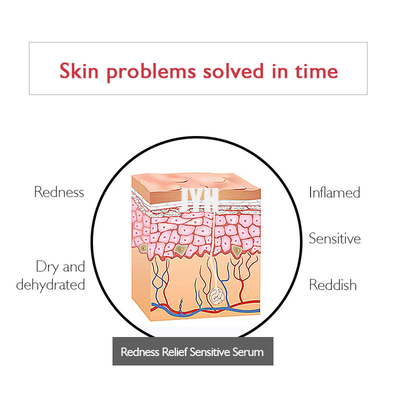 Kızarıklığı azaltmak için Oem Private Label Organik kızarıklık önleyici serum yüz serumu