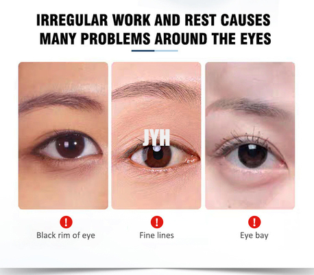 15ml OEM Deri Bakım Ürünleri Revitalizing Anti Aging Eyebag Removal Eye Cream